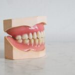 teeth mold to explain recurring swollen gums