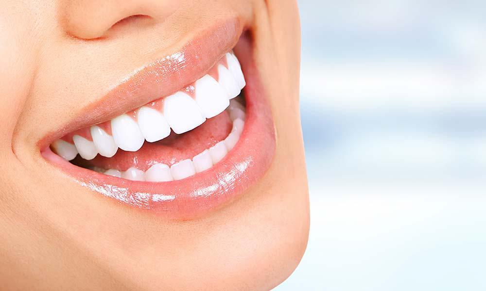 close up of woman's bright white smile
