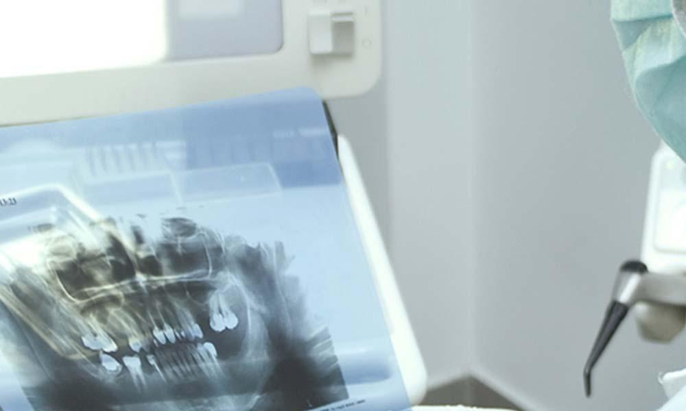 doctor watching dental x ray of patient
