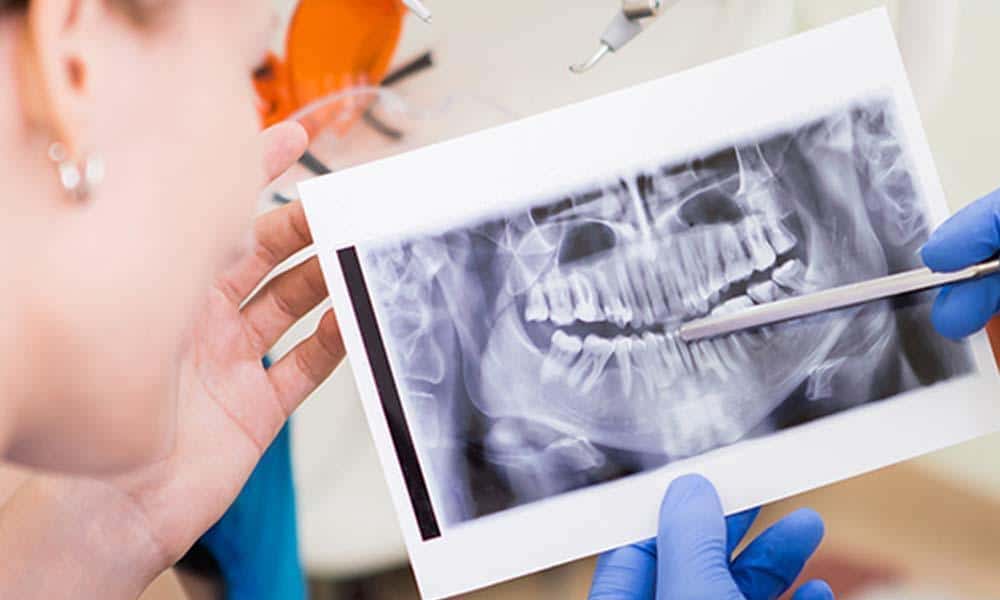 woman looking at x ray of her teeth