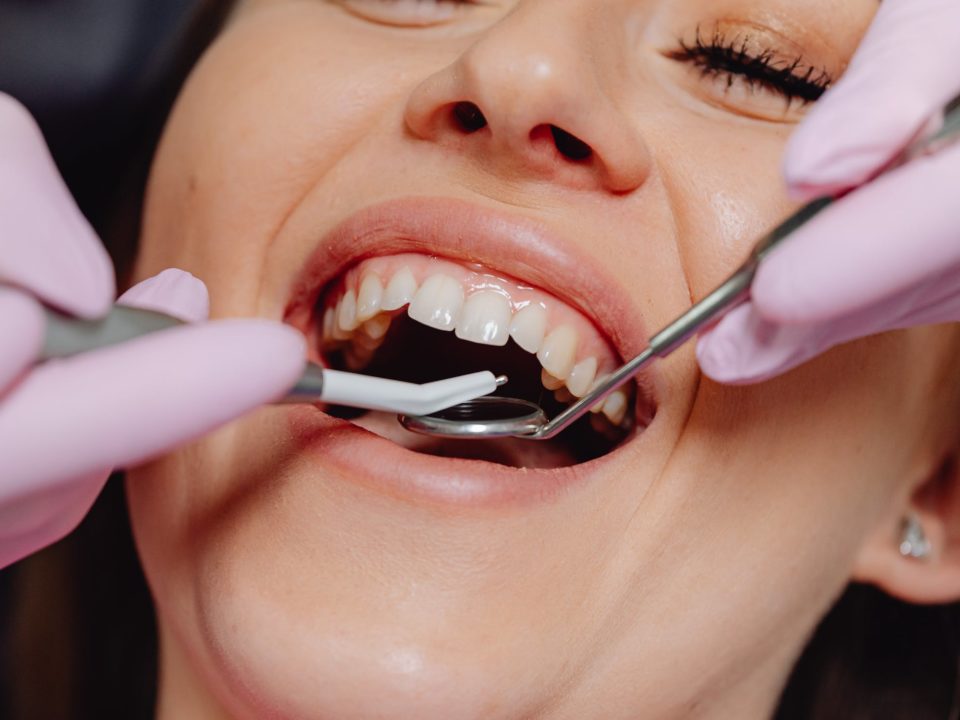 woman opening mouth and gloved hands using dental tools